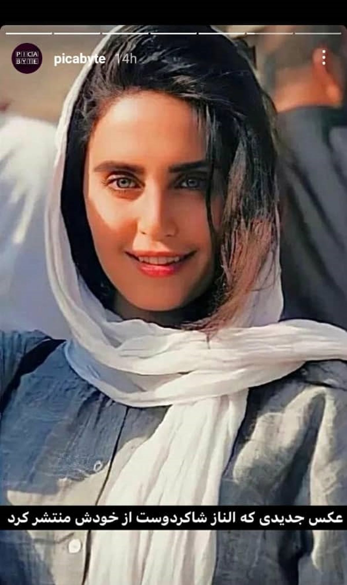 ست آبی دوست داشتنی الناز شاکردوست همرنگ چشم هایش| الناز شاکردوست هم به تزریق زیبایی صورت روی آورد!| جواهرات گران قیمت الناز شاکردوست