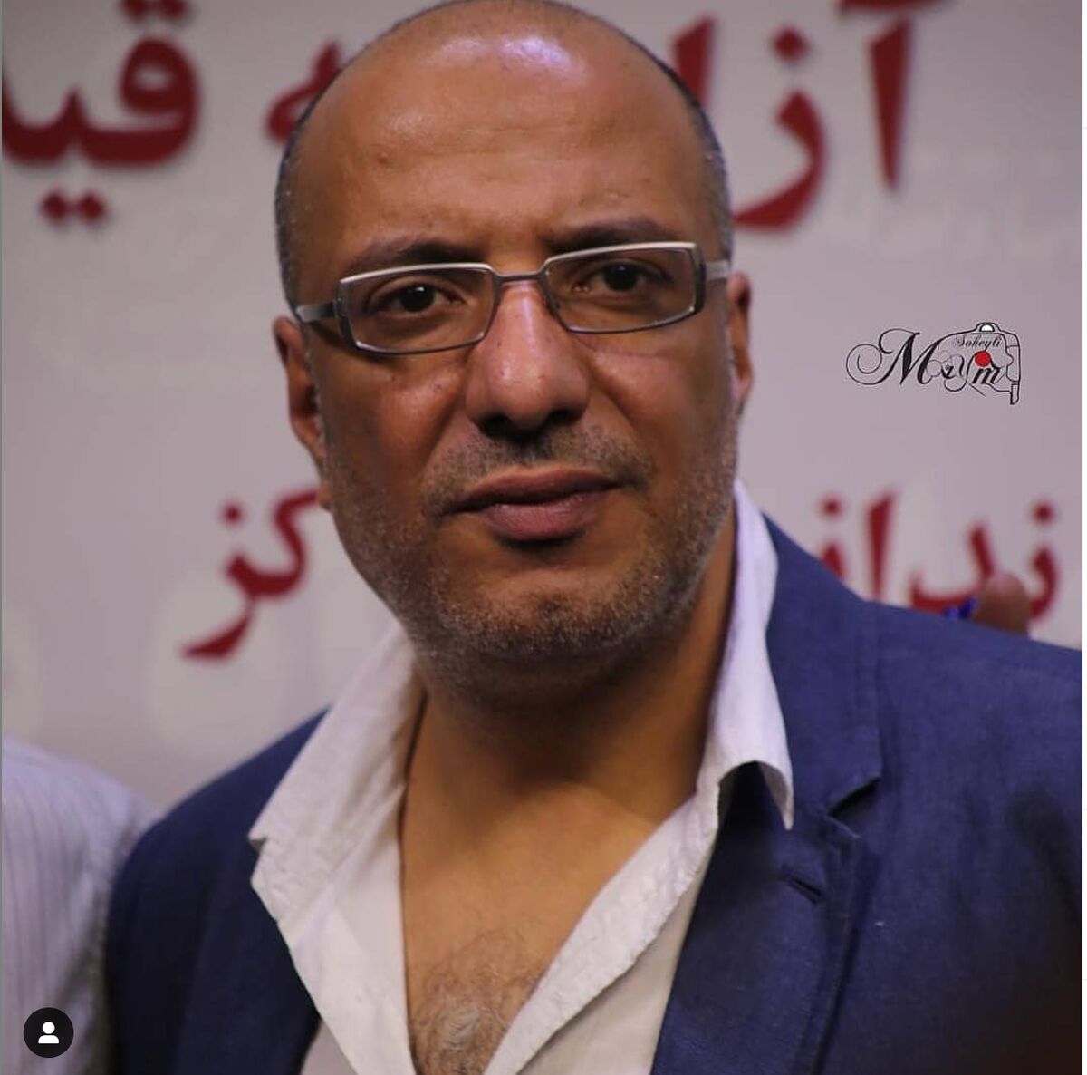 تغییر چهره عجیب امیر جعفری در سریال جیران جنجالی شد