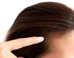 استرس زیاد باعث ریزش مو می ‌شود + جزئیات
