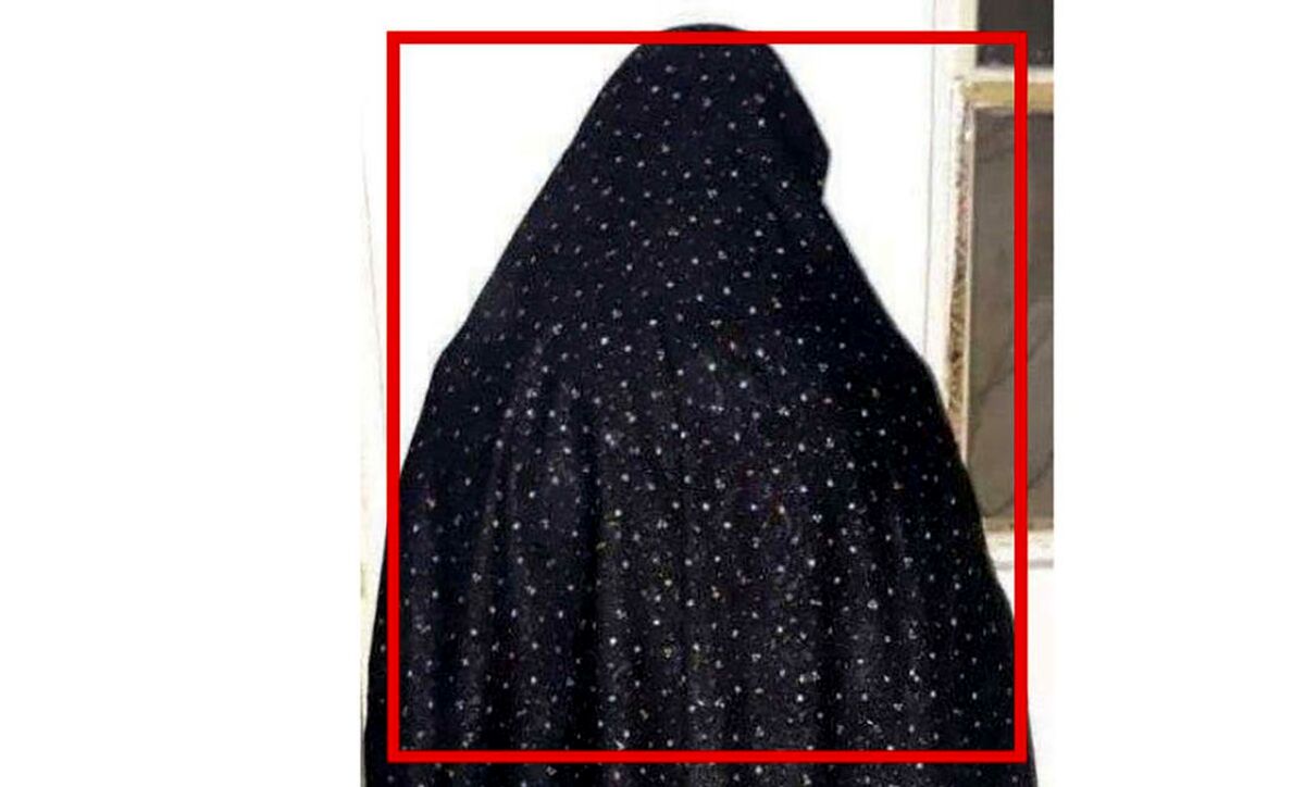 اسیدپاشی وحشتناک دختر بدجنس به روی پدر+ عکس