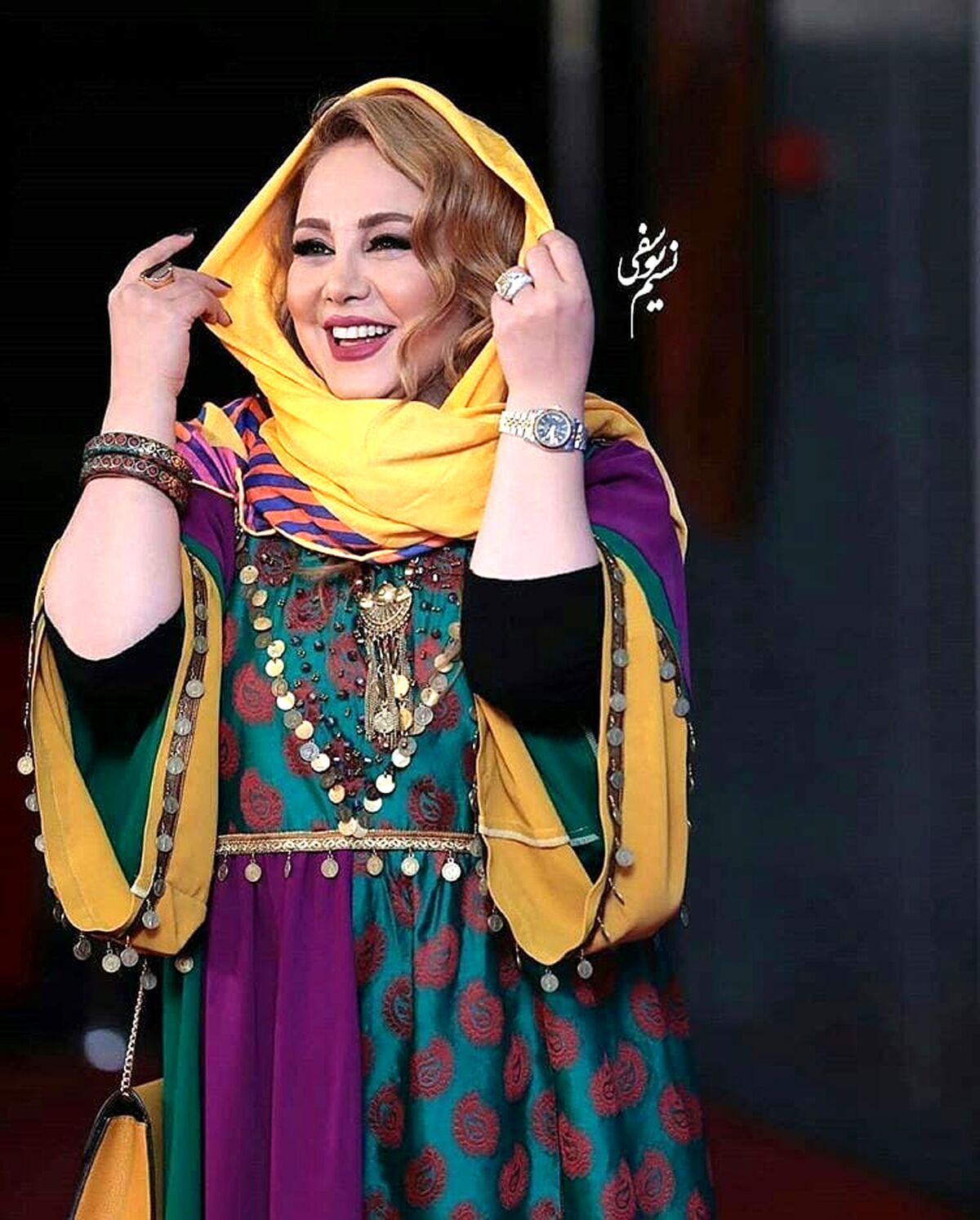 سلفی خجالت آور بهنوش بختیاری با صورت تزریقی ورم کرده!