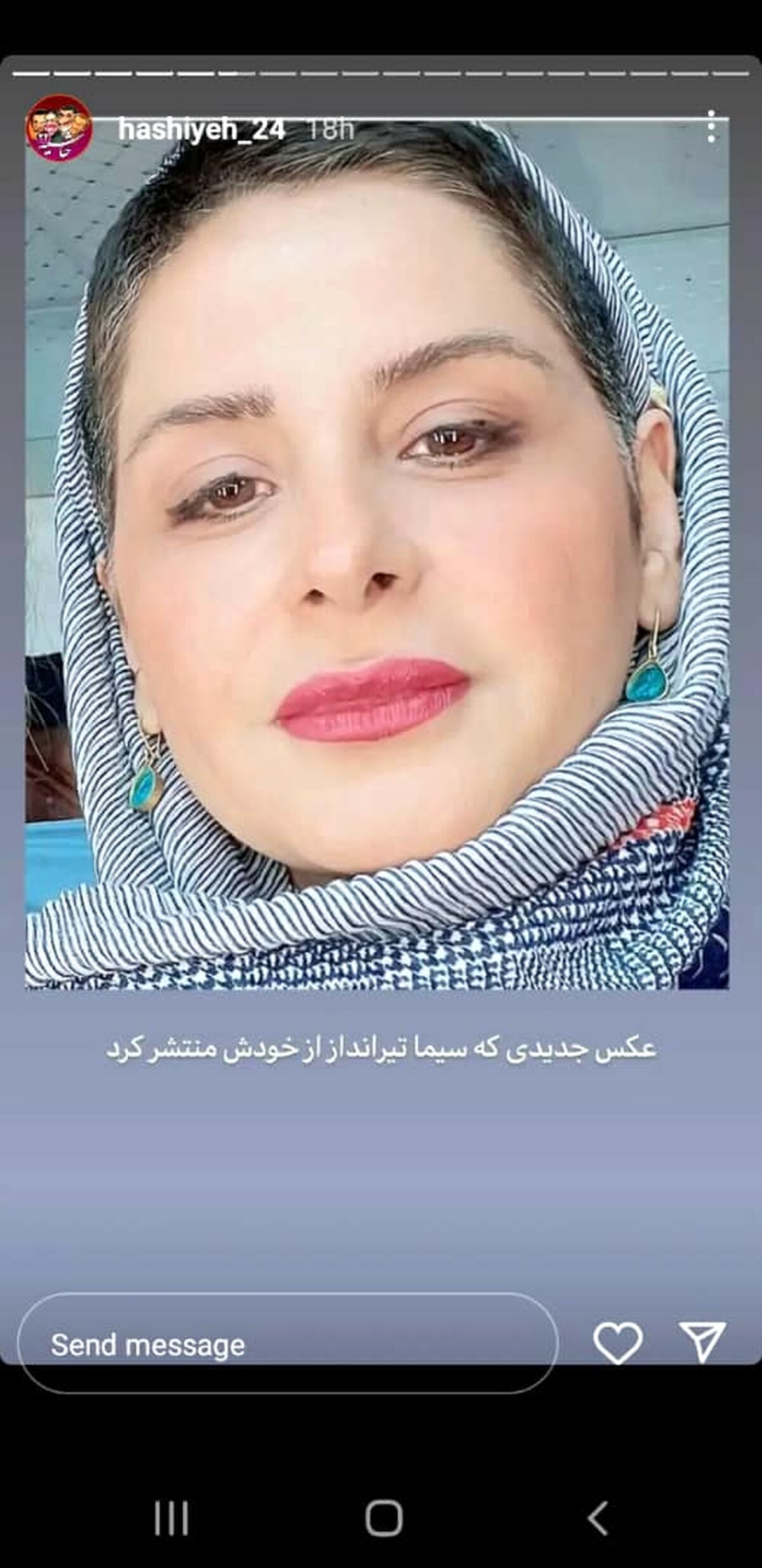 بوتاکس خیلی تابلوی سیما تیرانداز تو ذوق زد! | سیما تیرانداز هم قاطی خانومای تزریقی شد!