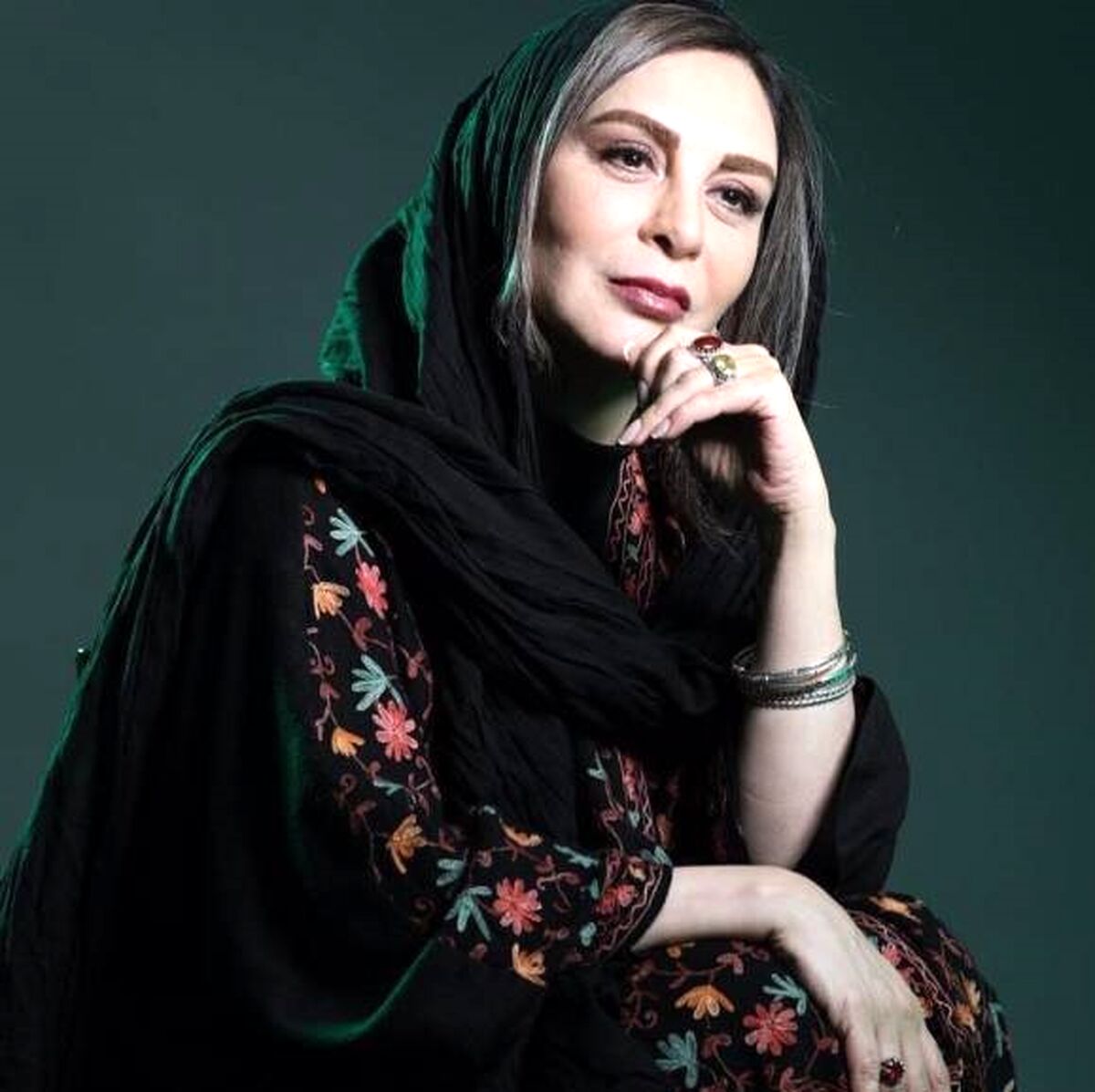 تغییر چهره اسفناک افسانه بایگان| عمل های جراحی وحشتناک افسانه بایگان