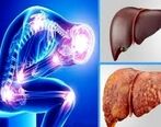 چرا مبتلایان به کبد چرب جان خود را از دست می دهند؟