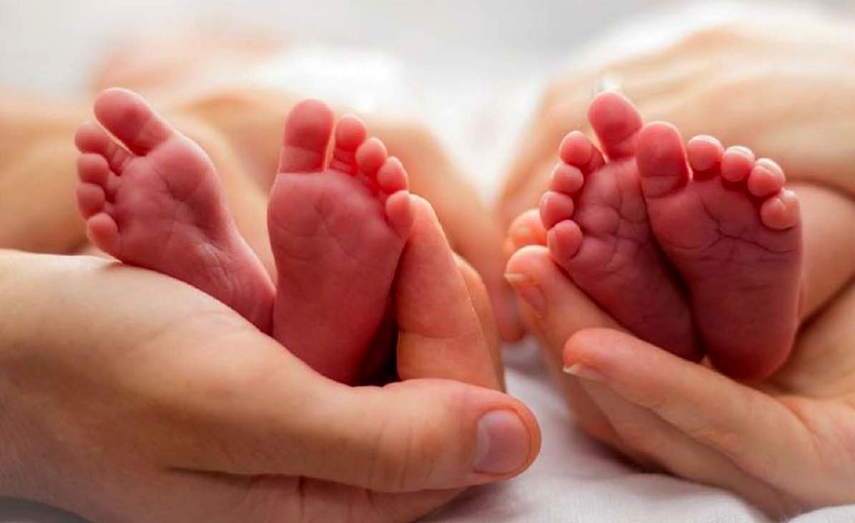 زیباترین دو قلوهای بهم چسبیده را ببینید