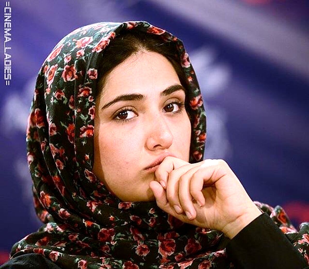 کبره وحشتناک صورت باران کوثری | باران کوثری مریض شد!+ عکس شوکه کننده