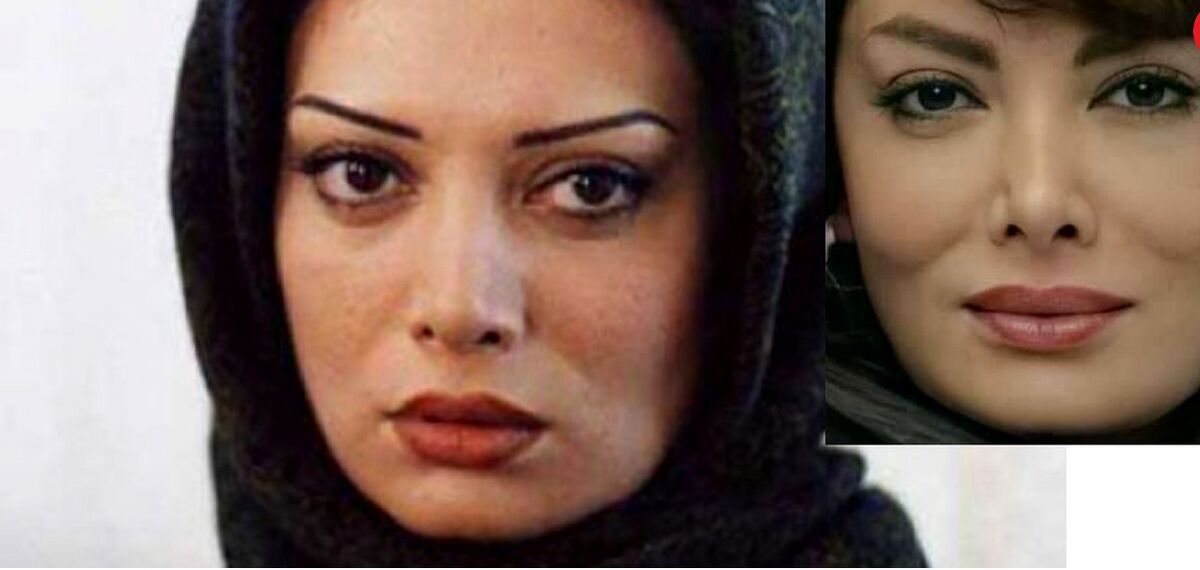 بازیگران این سریال  محبوب همه از نظر قیافه  نابود شدن!