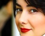 صورت هانیه توسلی نابود شد| عکسی که باور نمی کنید