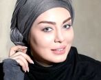 ورم عجیب صورت سحر قریشی بعد از تزریق زیبایی| صورت سحر قریشی نابود شد+ عکس