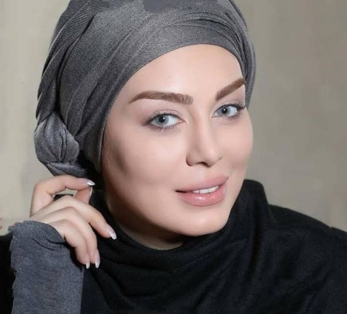 ورم عجیب صورت سحر قریشی بعد از تزریق زیبایی| صورت سحر قریشی نابود شد+ عکس