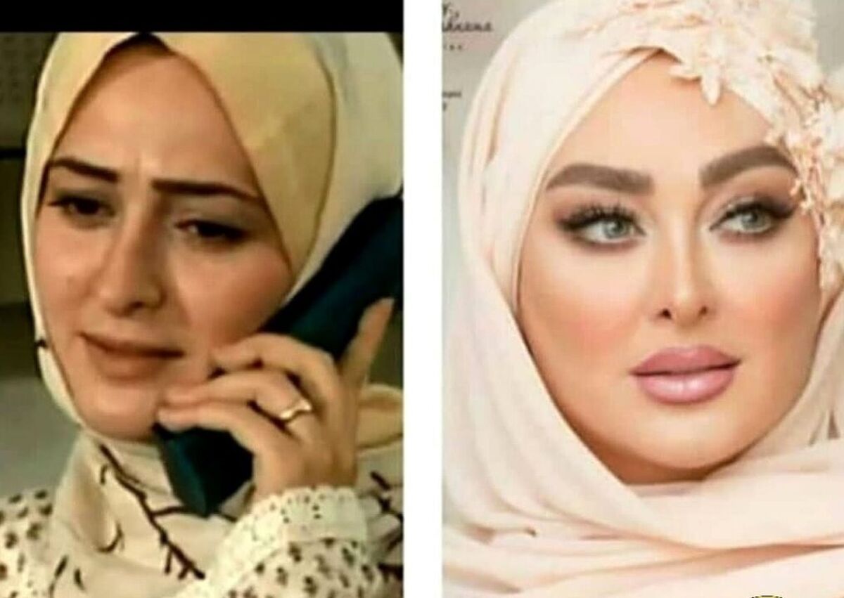 الهام حمیدی صورت خود را نابود کرد | الهام حمیدی با مژه هایش از دست رفت! 