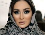 اسیدپاشی به صورت الهام حمیدی! | الهام حمیدی زیبایی چهره اش را از دست داد