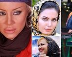 زیبایی پلاستیکی  این چند بازیگر زن ایرانی را ببینید! | جراحی پلاستیکو تا آخر راه رفتن!