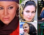 زیبایی پلاستیکی  این چند بازیگر زن ایرانی را ببینید! | جراحی پلاستیکو تا آخر راه رفتن!