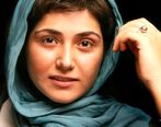 تغییر چهره وحشتناک باران کوثری/ عکس دیده نشده