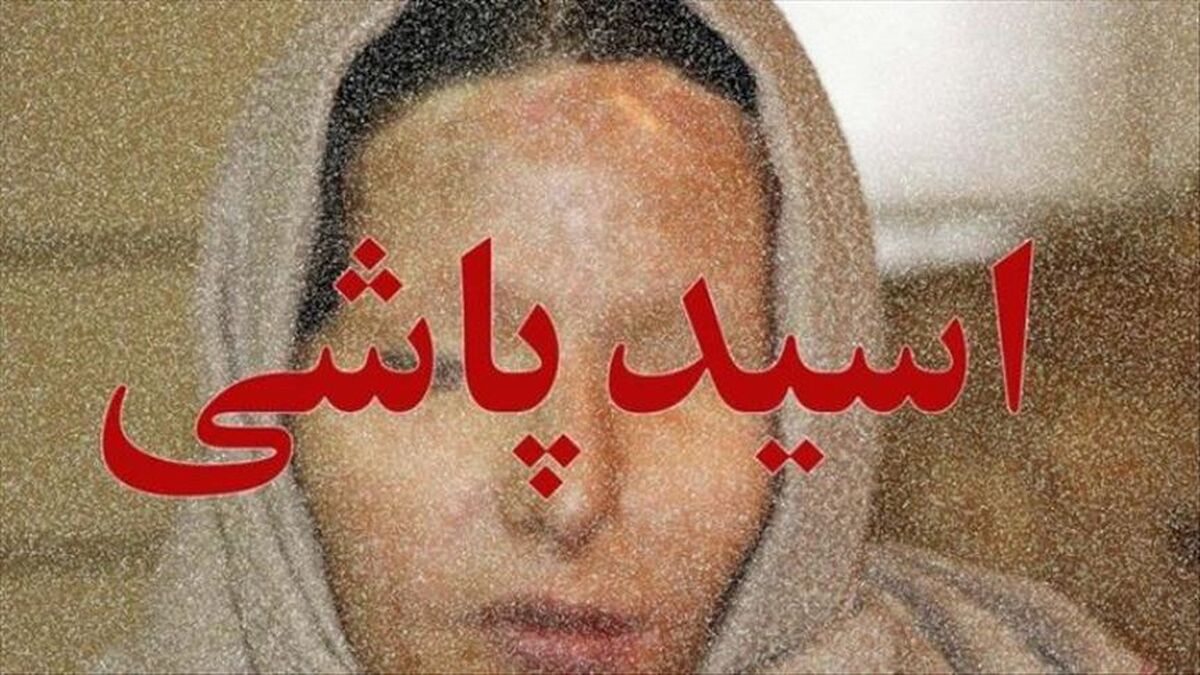 زن جوان قربانی اسیدپاشی شد | اسیدپاشی هولناک مرد ناشناس به زن جوان