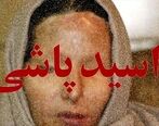زن جوان قربانی اسیدپاشی شد | اسیدپاشی هولناک مرد ناشناس به زن جوان