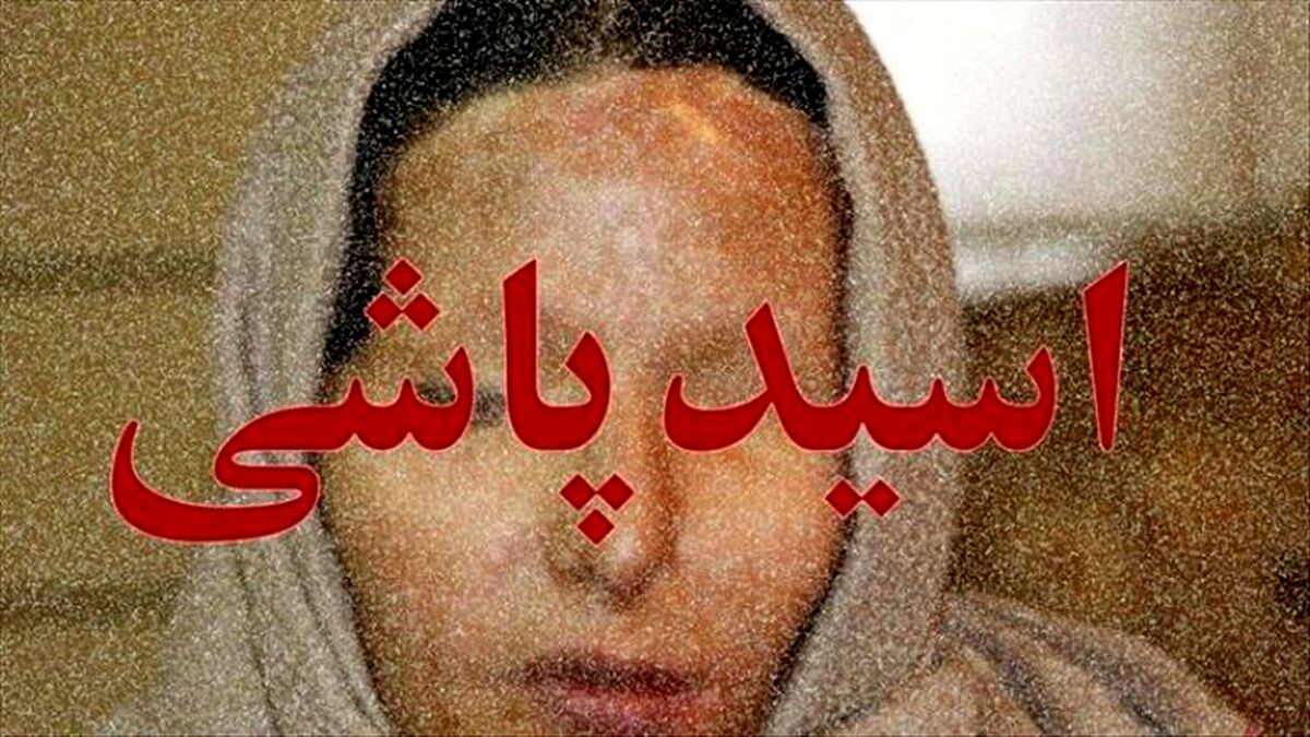 اسید پاشی به پدر و کودک خردسال قلب همه را به درد آورد