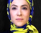 چشم هیولای ویشکا آسایش با پف های تزریقی| ویشکا آسایش با این هفت قلم با صورت خودش چه کرد؟ | ویشکا آسایش هم از دست رفتنی شد