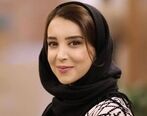 کج شدن فک بازیگر مشهور