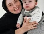 عکس قبل و بعد عمل زیبایی ژاله صامتی را مقایسه کنید! 