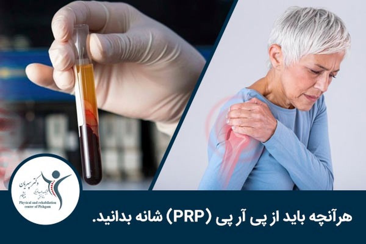 هرآنچه باید از پی آر پی (PRP) شانه بدانید.