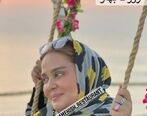  فرم چشم بهاره رهنما بعد عمل بهم ریخت!
