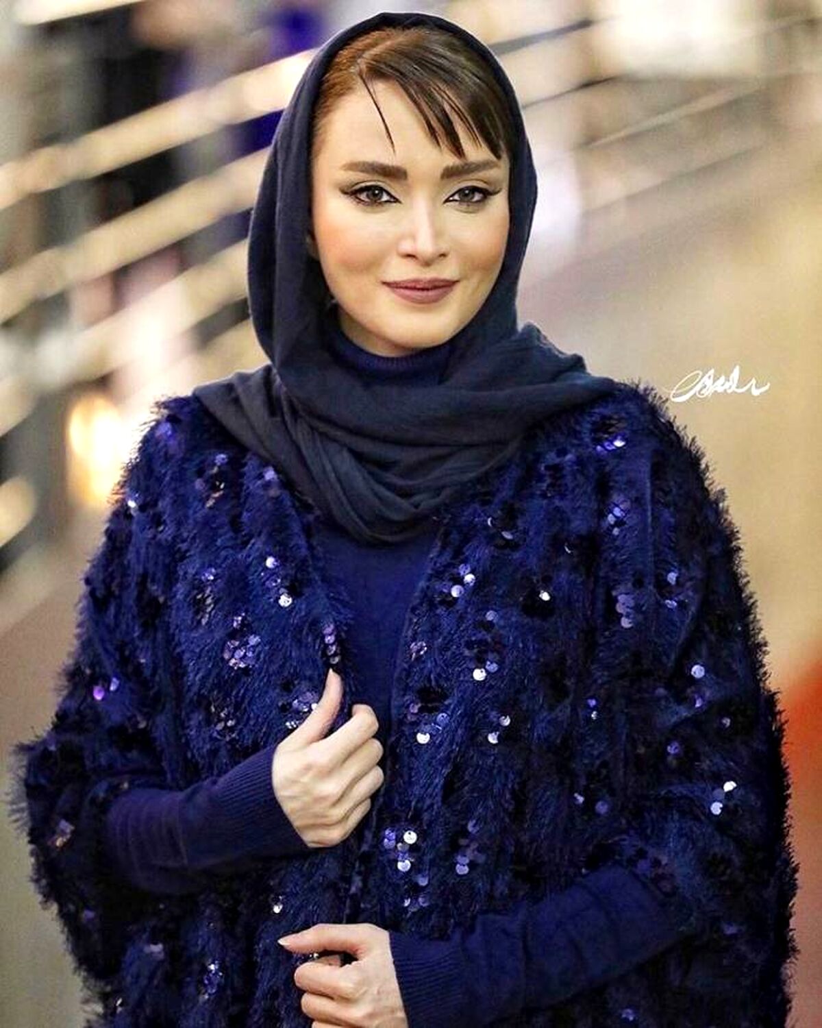 تغییر شوک آور چهره بهنوش طباطبایی بعد از 20 سال | بهنوش طباطبایی با چند تا عمل جراحی و تزریق از خودش بازیگر بیرون آورد؟