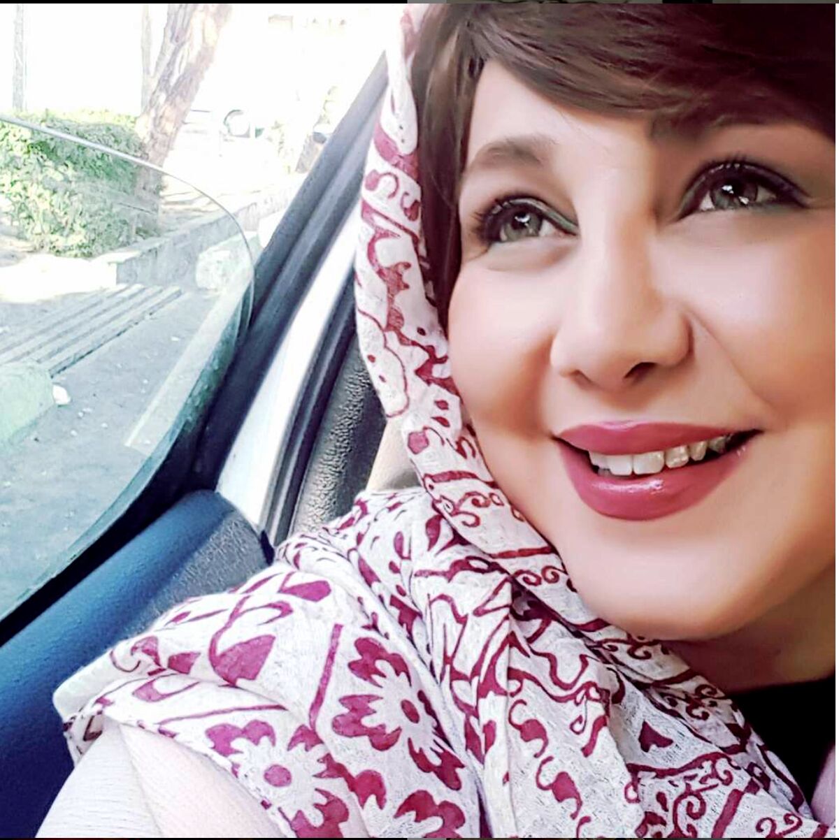 عکس باور نکردنی از چهره قبل عمل بهنوش بختیاری