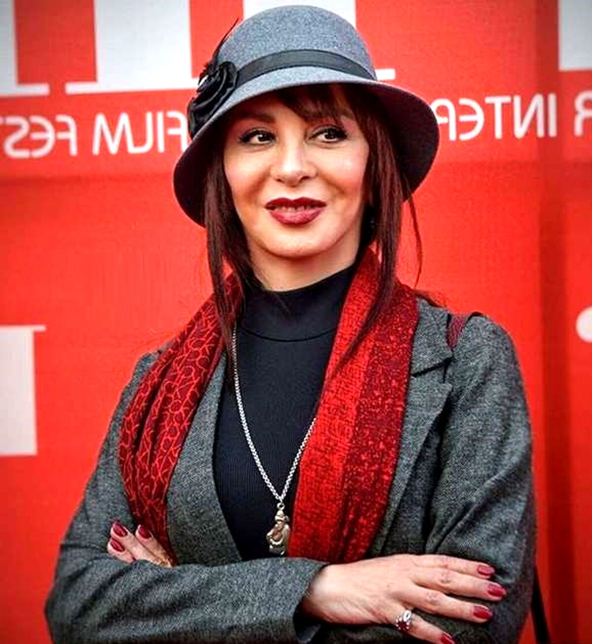  افسانه بایگان با صورت پروتزی در 60 سالگی کنار مرد جوان قرار گرفت