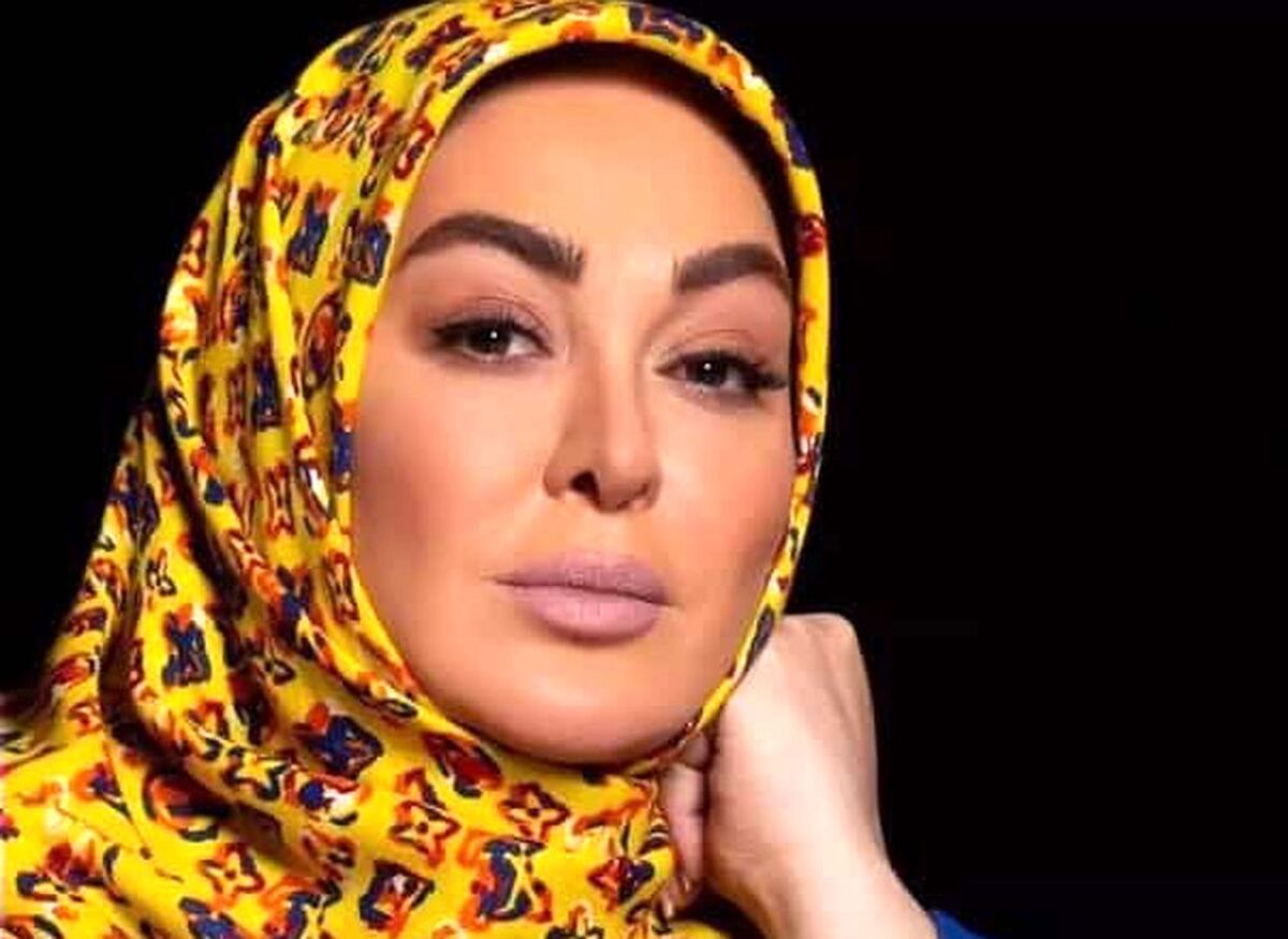 تغییر چهره عجیب الهام حمیدی قبل و بعد از عمل جراحی + عکس های الهام حمیدی 