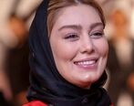 سحر قریشی چه بلایی سر چهره خود آورده است؟