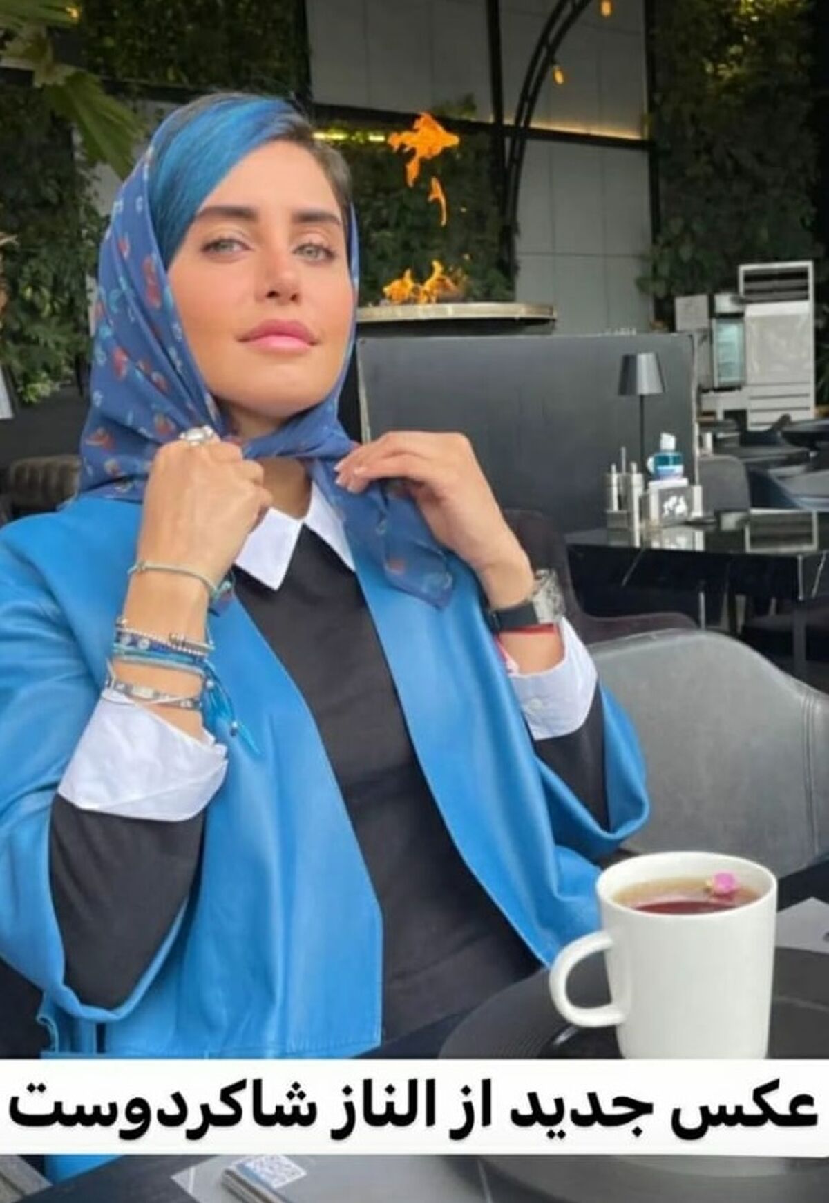 حادثه وحشتناک برای الناز شاکردوست | بینی الناز شاکردوست دفرمه شد! | چه اتفاقی برای الناز شاکردوست افتاده است؟