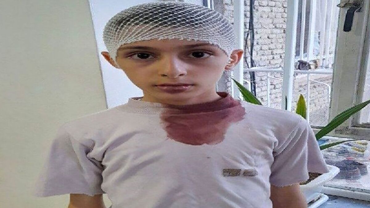 سر و کله خونی دانش آموز کتک خورده از معلم اشنویه ای