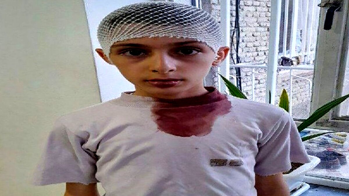سر و کله خونی دانش آموز کتک خورده از معلم اشنویه ای