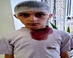 سر و کله خونی دانش آموز کتک خورده از معلم اشنویه ای