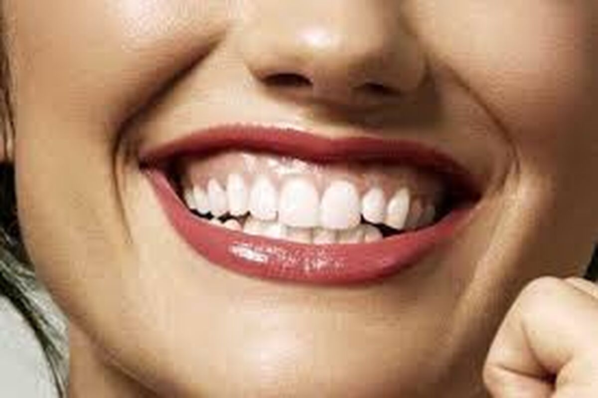 چگونه از لثه‌هایمان به درستی مراقبت کنیم؟