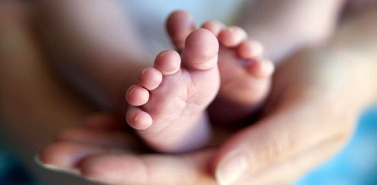 به دنیا آمدن نوزاد ترسناک با دو سر و سه دست!+ عکس