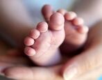 به دنیا آمدن نوزاد ترسناک با دو سر و سه دست!+ عکس