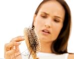 دلیل اصلی ریزش مو چیست؟