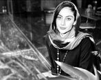 چهره ناجور ترلان پروانه بعد از تزریق و جراحی زیبایی + عکس 