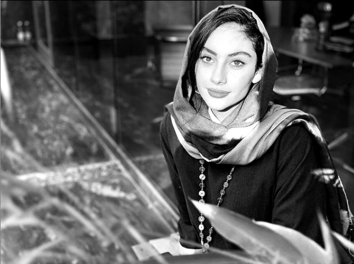 چهره ناجور ترلان پروانه بعد از تزریق و جراحی زیبایی + عکس 